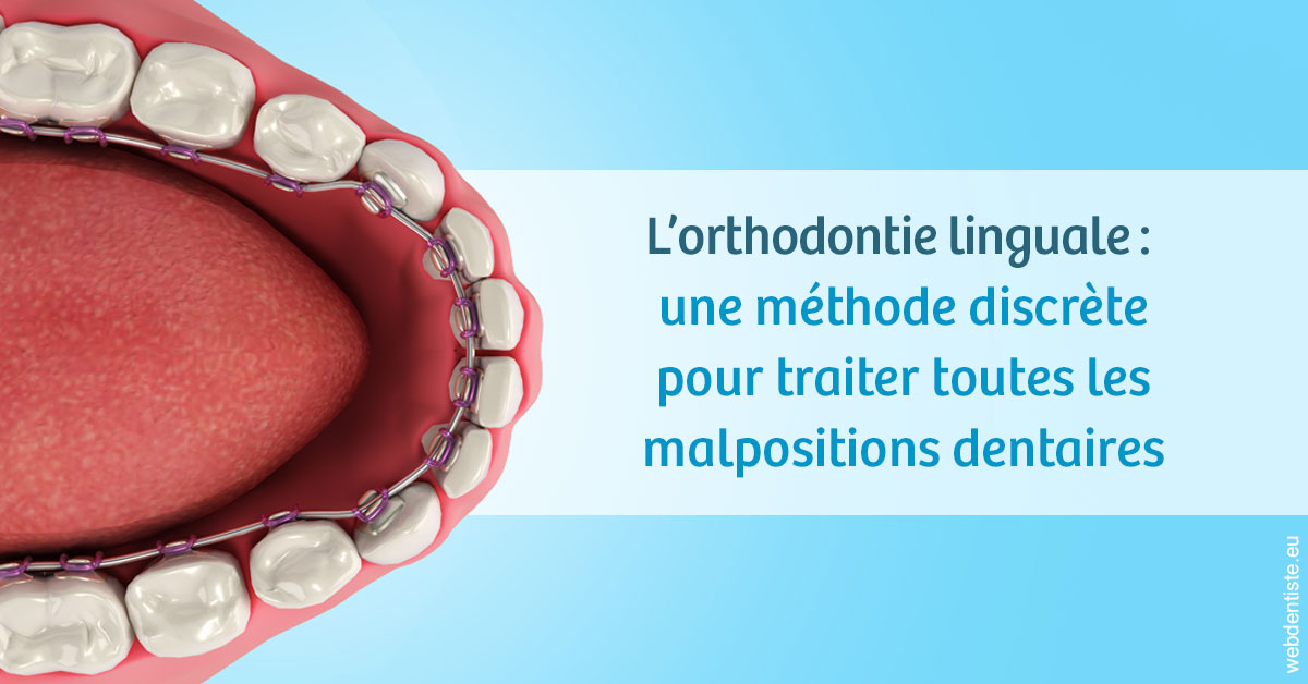 https://dr-bulthe-pierre.chirurgiens-dentistes.fr/L'orthodontie linguale 1