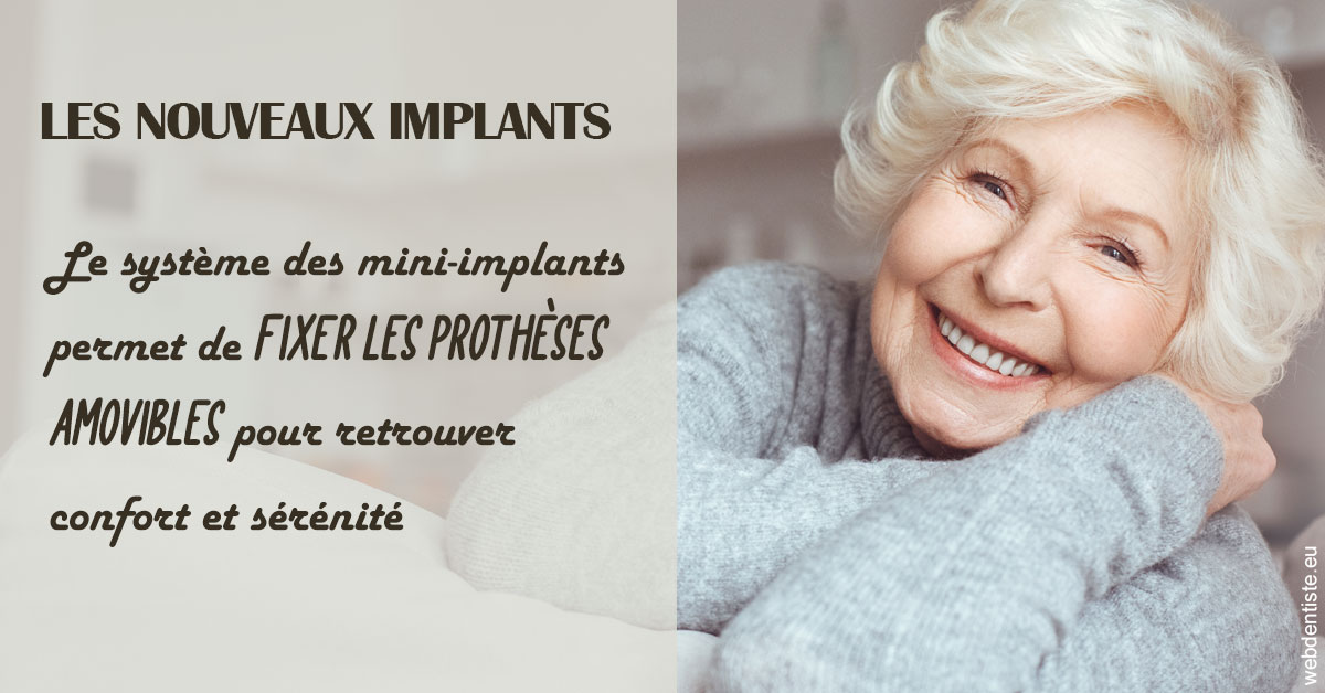 https://dr-bulthe-pierre.chirurgiens-dentistes.fr/Les nouveaux implants 1