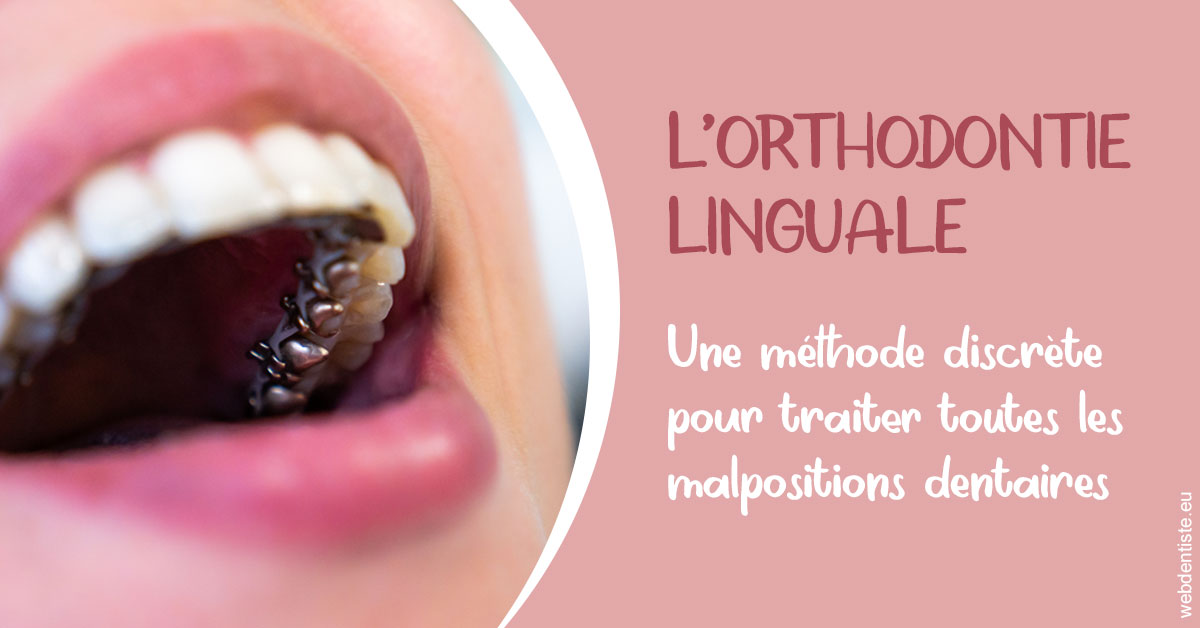https://dr-bulthe-pierre.chirurgiens-dentistes.fr/L'orthodontie linguale 2