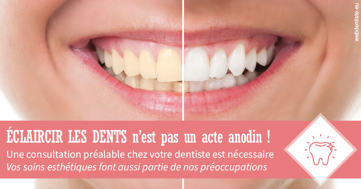 https://dr-bulthe-pierre.chirurgiens-dentistes.fr/Eclaircir les dents 1