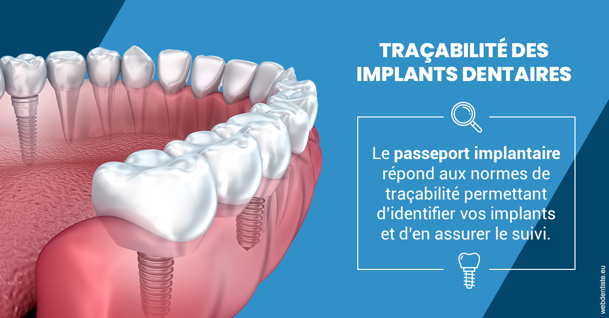 https://dr-bulthe-pierre.chirurgiens-dentistes.fr/T2 2023 - Traçabilité des implants 1