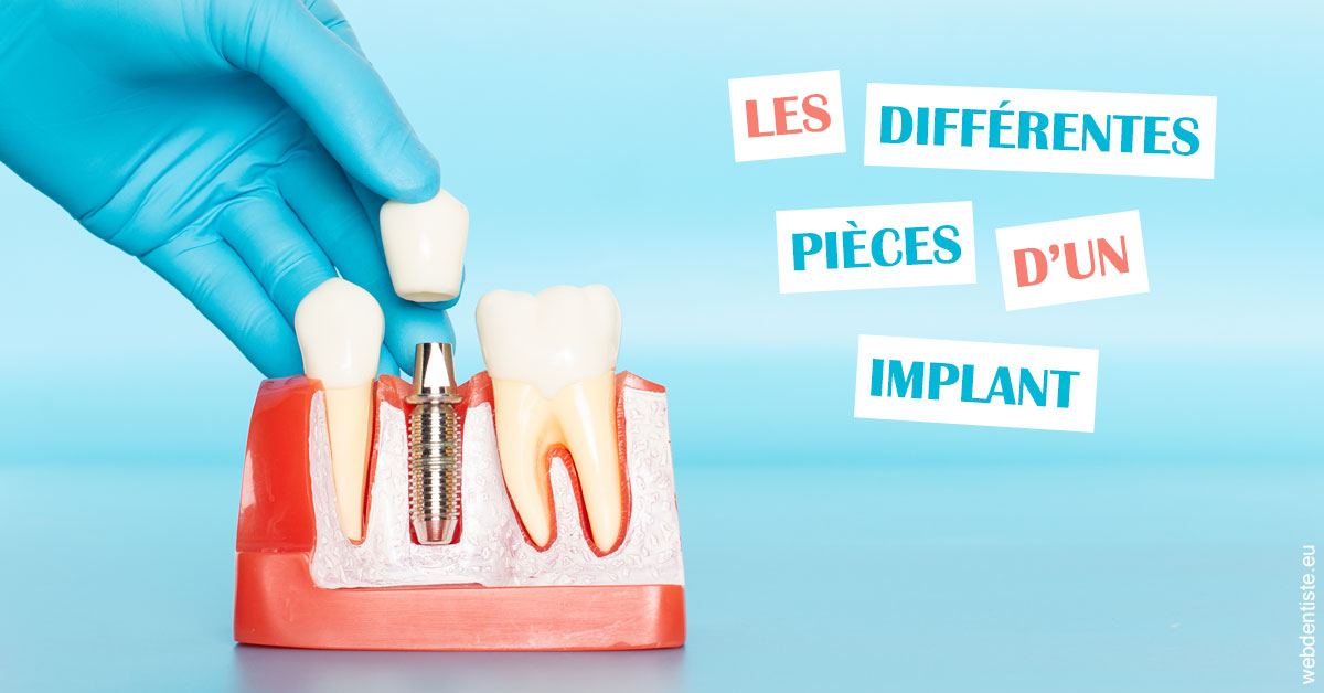 https://dr-bulthe-pierre.chirurgiens-dentistes.fr/Les différentes pièces d’un implant 2