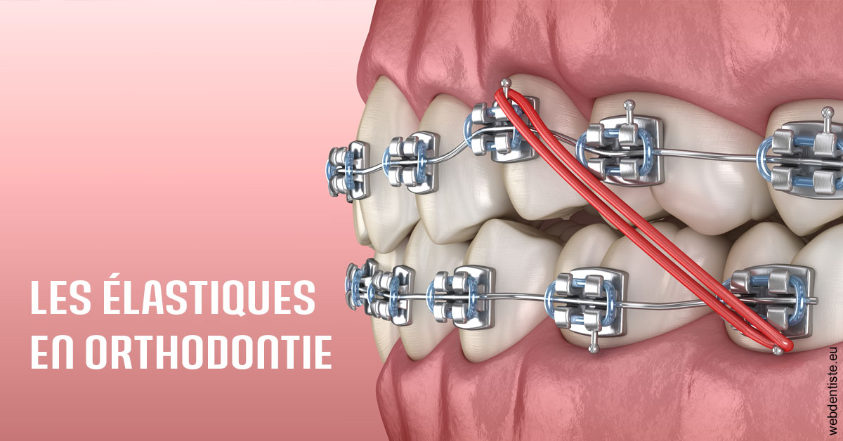 https://dr-bulthe-pierre.chirurgiens-dentistes.fr/Elastiques orthodontie 2